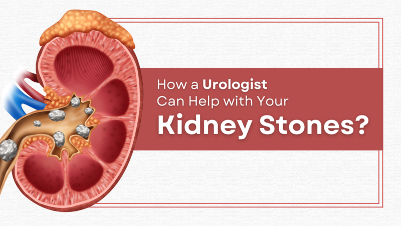 Kidney Stone Surgery: Recovery, Complications, and Types