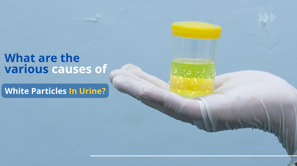 White Particles in Urine