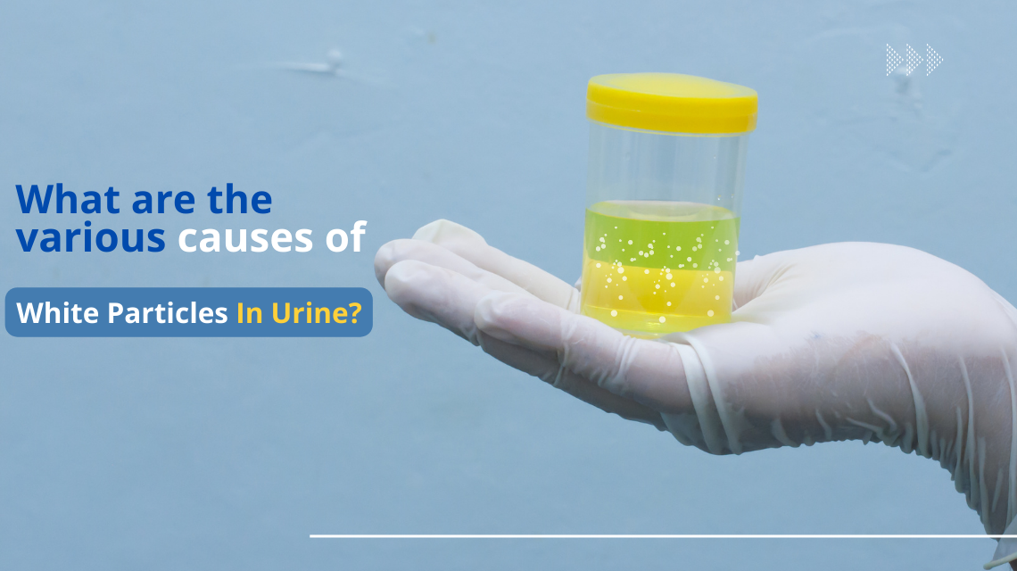 White Particles In Urine 