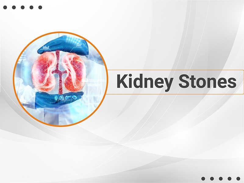 kidney stone