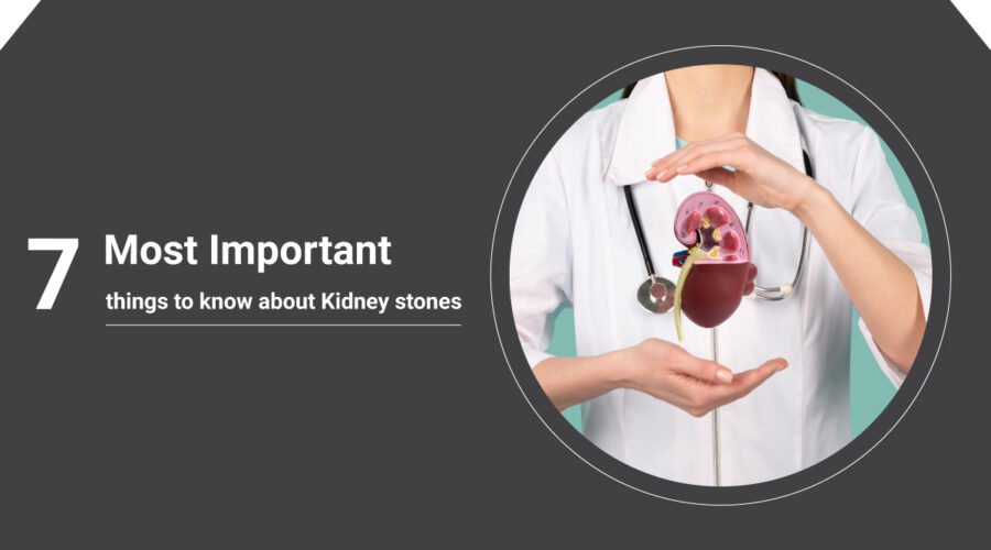 know about Kidney stones