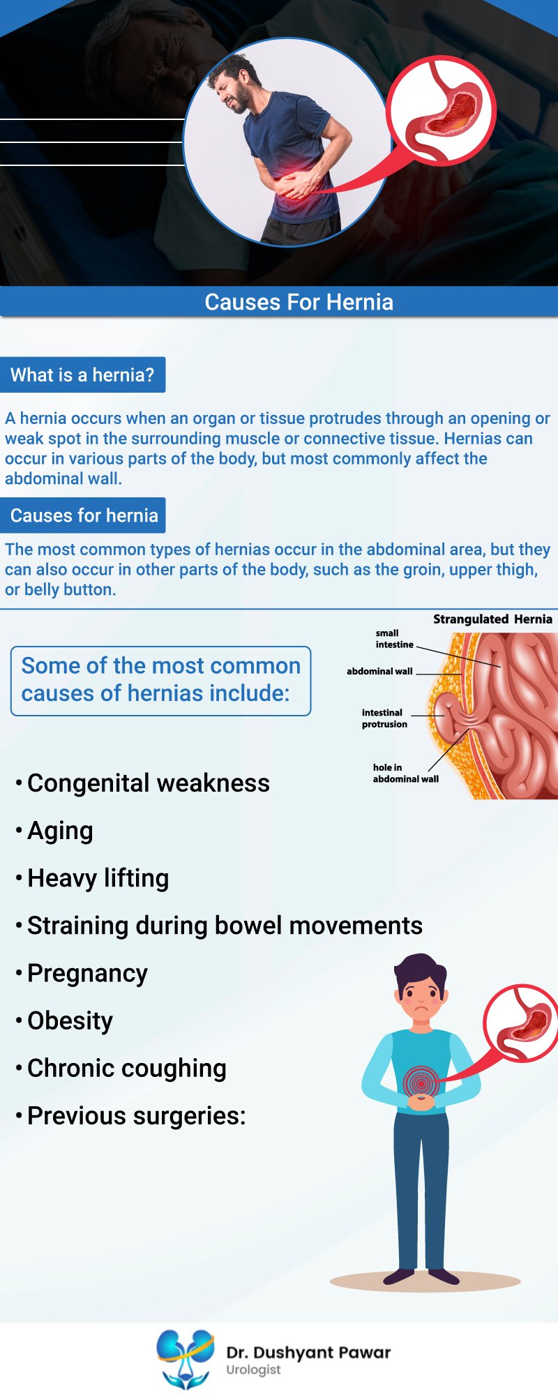 causes of hernia image