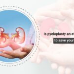 pyeloplasty treatment