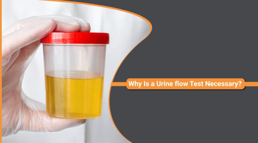 Urine flow Test