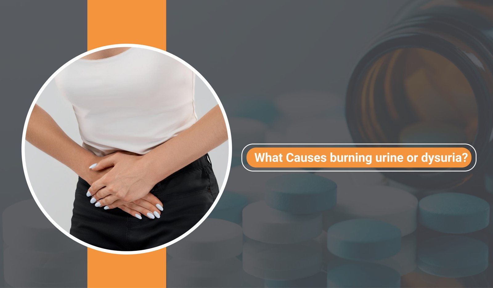 What Causes burning urine or dysuria
