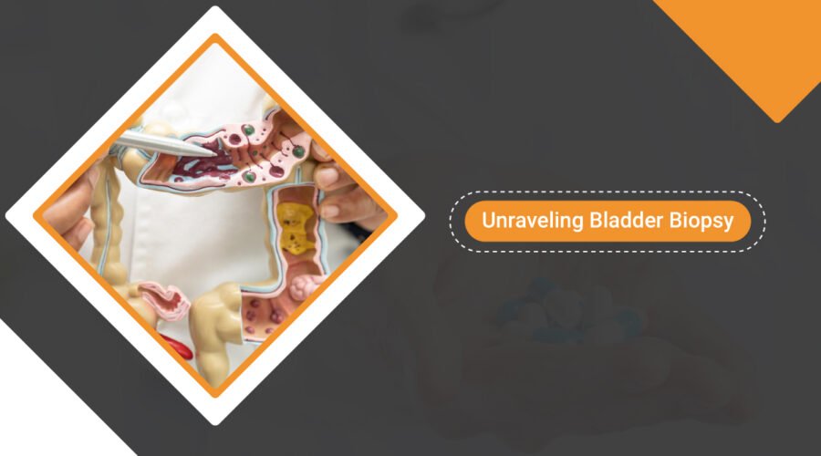 Unraveling Bladder Biopsy