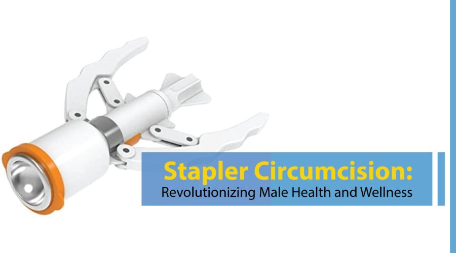 Stapler Circumcision Revolutionizing Male Health and Wellness