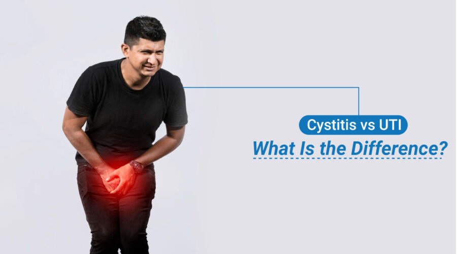 Cystitis vs UTI (Urinary Tract Infection)