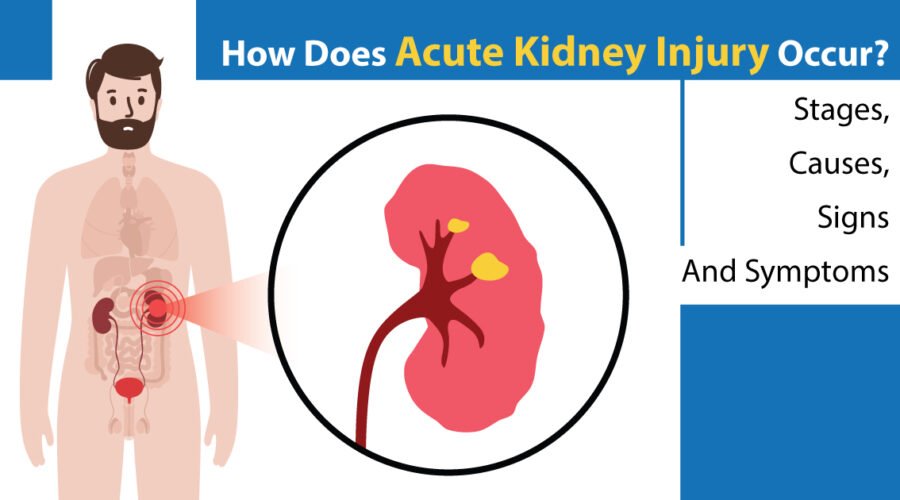 What Causes Acute Kidney Injury (AKI) What We Know About It