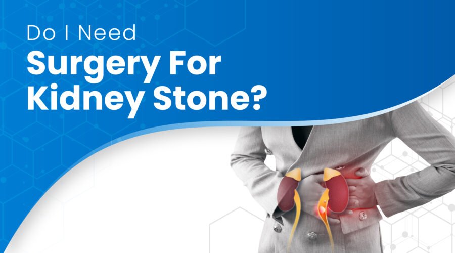 Do I Need Surgery for Kidney Stone