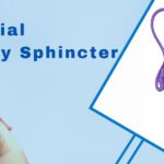 Artificial Urinary Sphincter in Incontinence Management