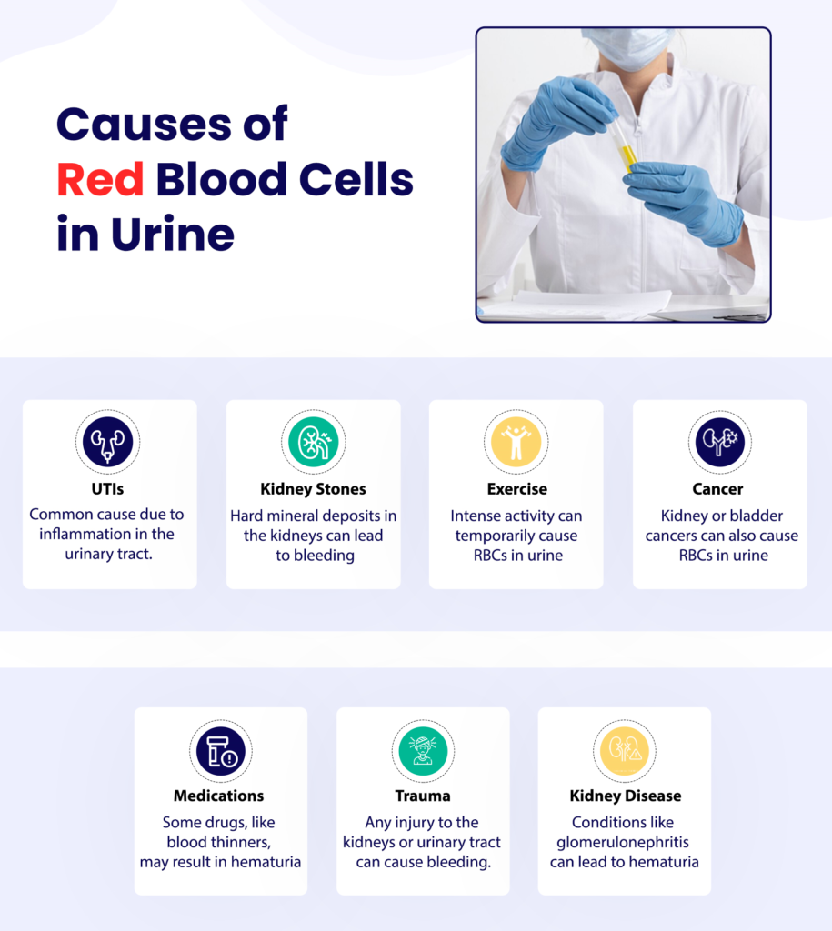 Causes of Red Blood Cells in Urine