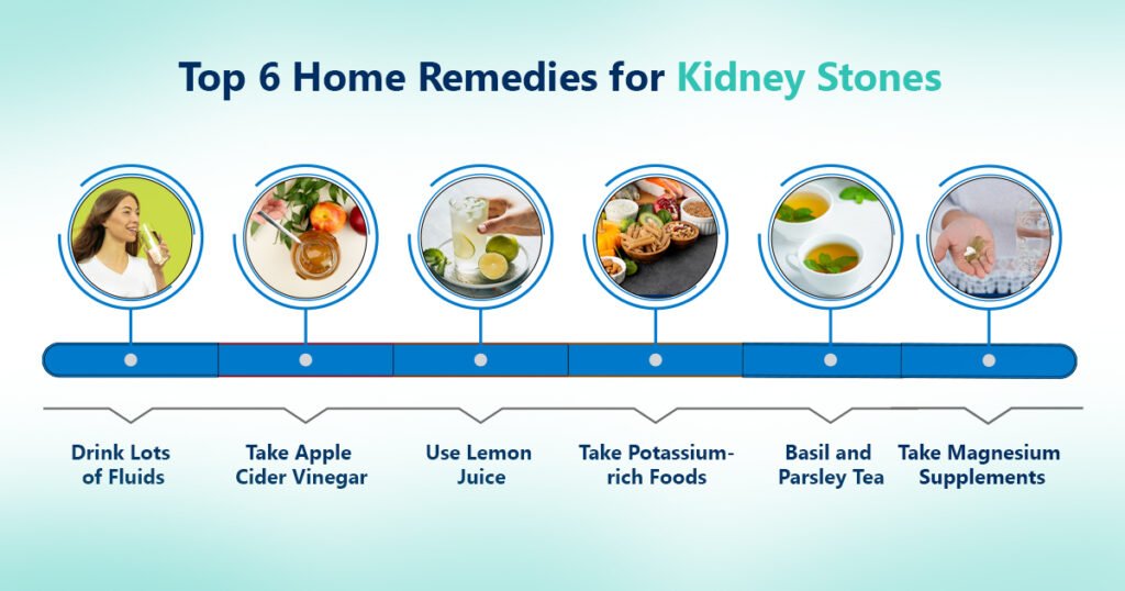 Top 6 Home Remedies for Kidney Stones