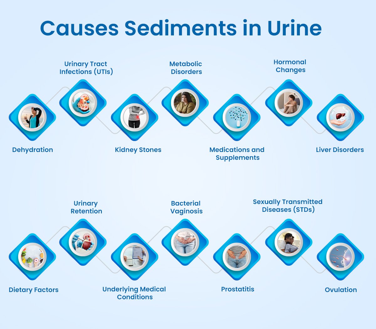 Causes of Sediment in Urine