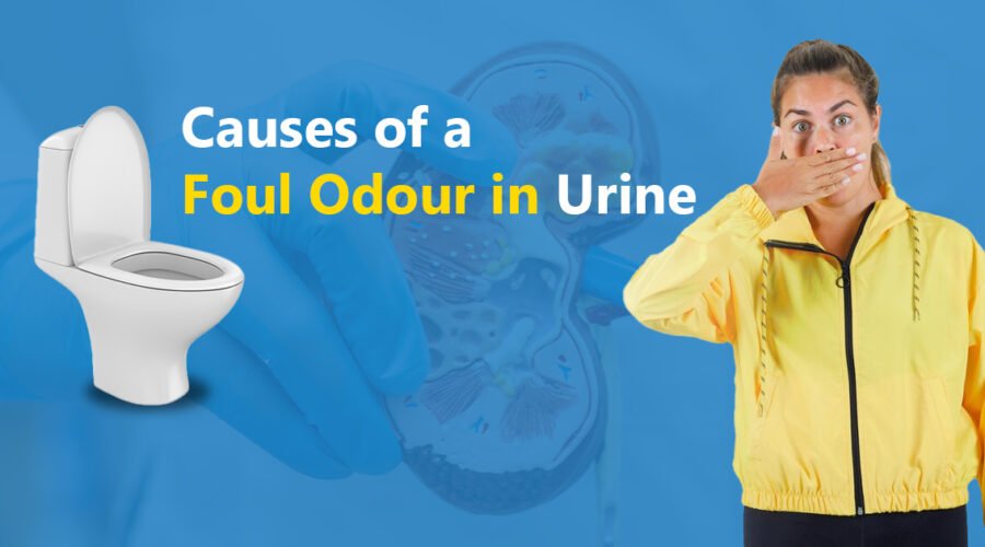 What Are the Common Causes of a Foul Odour in Urine