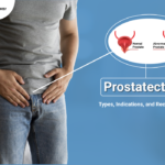 Prostatectomy Types, Indications, and Recovery Explained