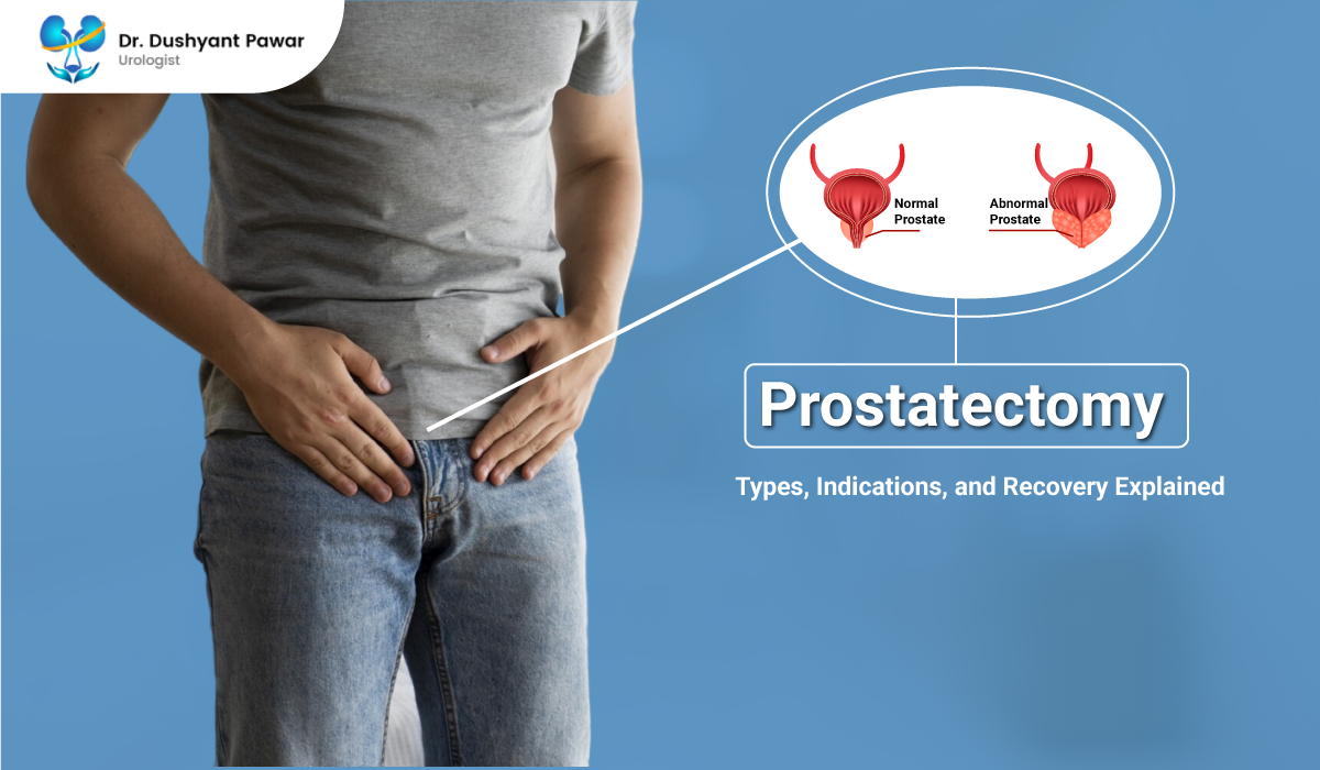 Prostatectomy Types, Indications, and Recovery Explained