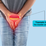 Traumatic Injury of the Bladder and Urethra