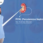 PCNL -Kidney Stone Specialist