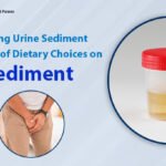 Urologist in AHmedabad Sediment analysis in urine