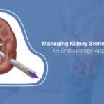 kidney stone diseases - Kidney Stones Managing