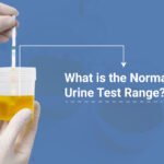 Normal Urine Test Urologist in Ahmedabad