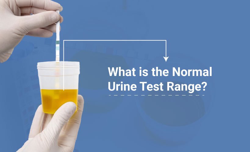 Normal Urine Test Urologist in Ahmedabad