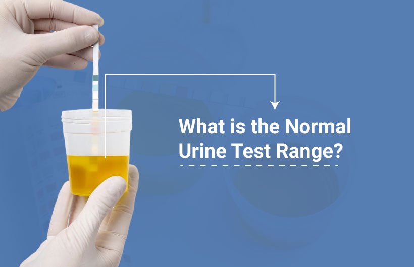 Normal Urine Test Urologist in Ahmedabad