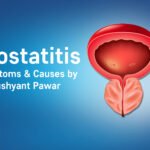 Prostatitis: Symptoms & Causes Urologist Ahmedabad