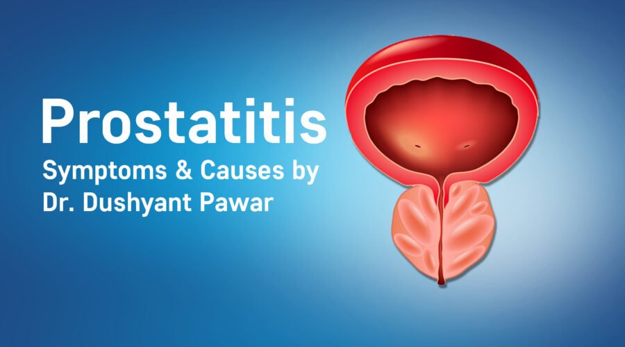 Prostatitis: Symptoms & Causes Urologist Ahmedabad