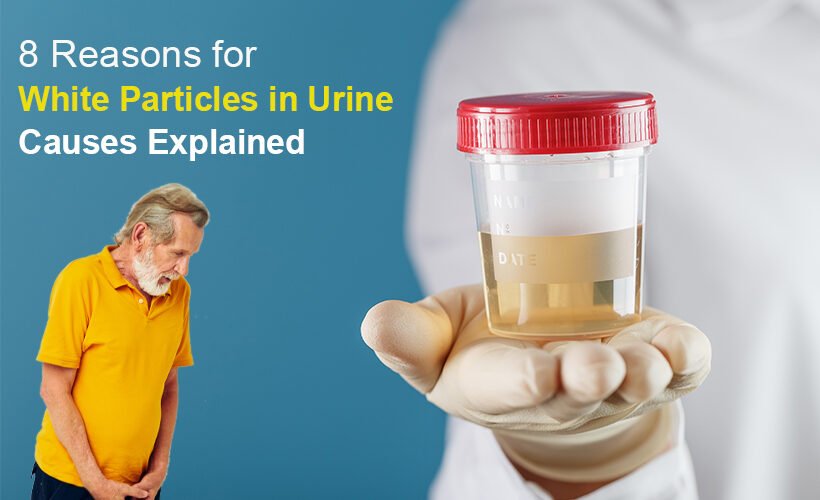 Reasons for White Particles in Urine