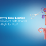 Vasectomy vs. Tubal Ligation