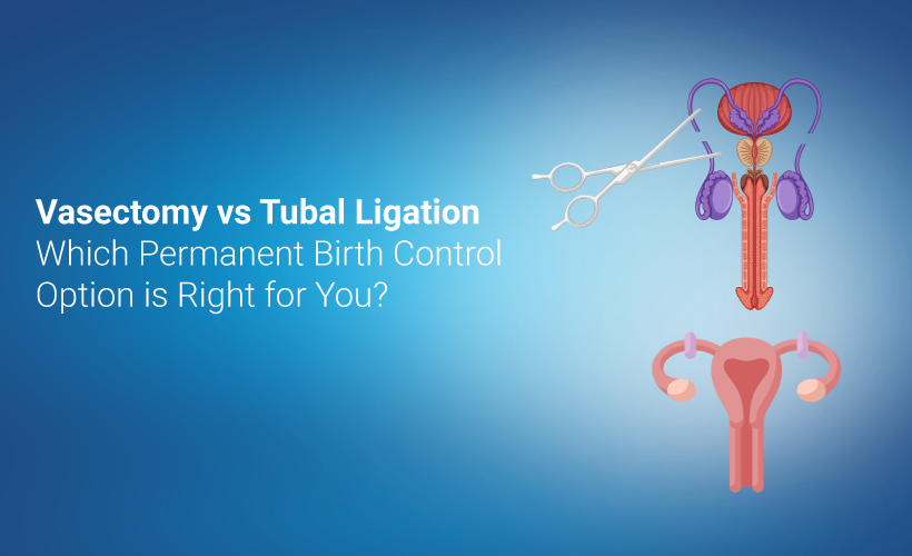 Vasectomy vs. Tubal Ligation