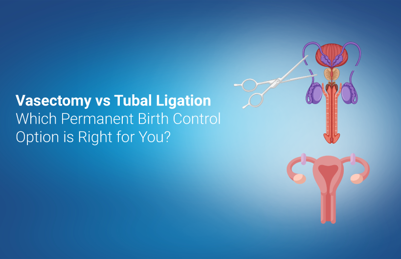 Vasectomy vs. Tubal Ligation