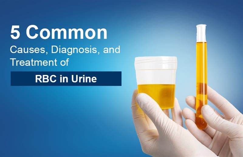 Causes of RBC in urine