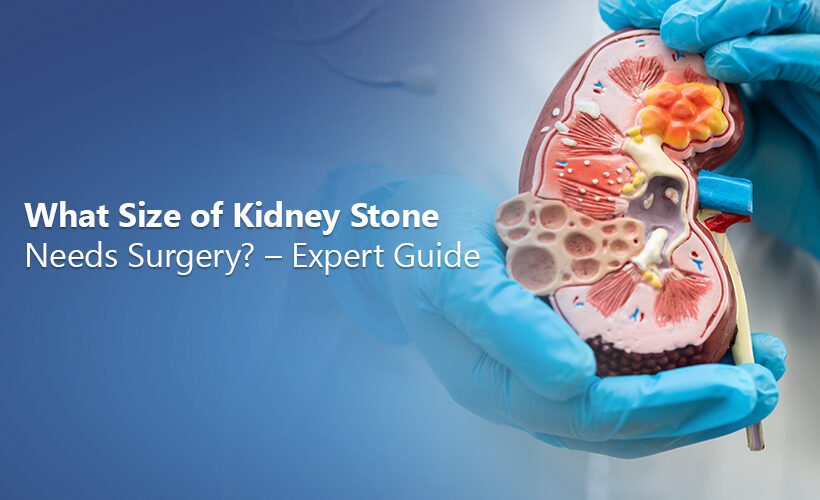 Kidney Stone Specialist in Ahmedabad