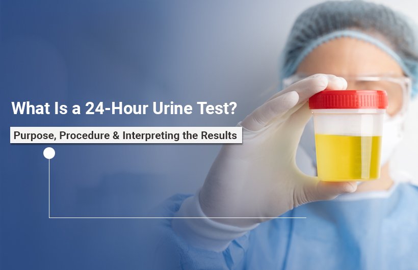 24-Hour Urine Test- Urologist in Ahmedabad