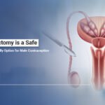 Vasectomy Treatment in Ahmedabad