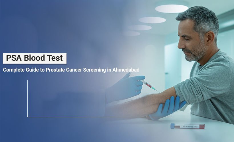 PSA Test for Prostate Cancer in Ahmedabad