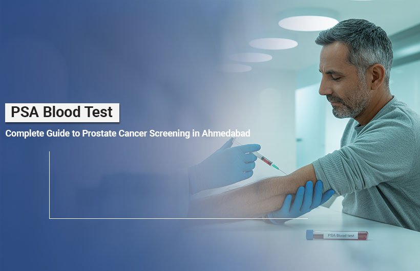 PSA Test for Prostate Cancer in Ahmedabad