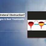 Ureteral Obstruction Causes and Treatment