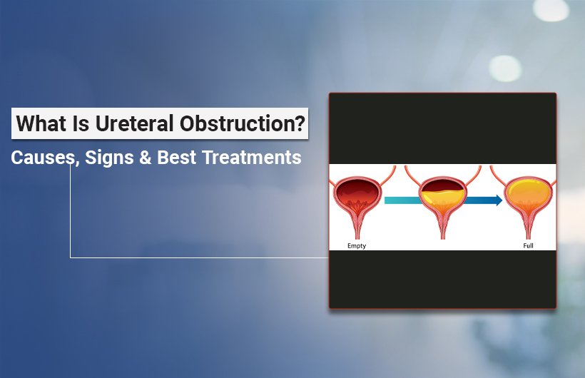 Ureteral Obstruction Causes and Treatment