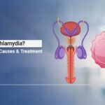 Chlamydia Causes and Symptoms