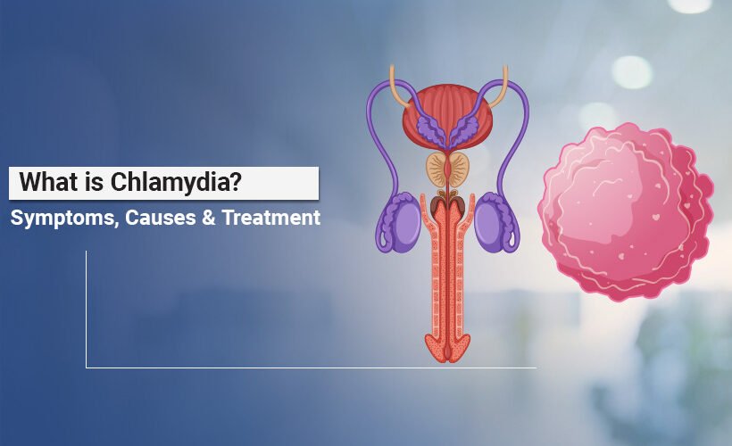 Chlamydia Causes and Symptoms