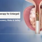 Rezum Therapy for prostate enlargement treatment without surgery