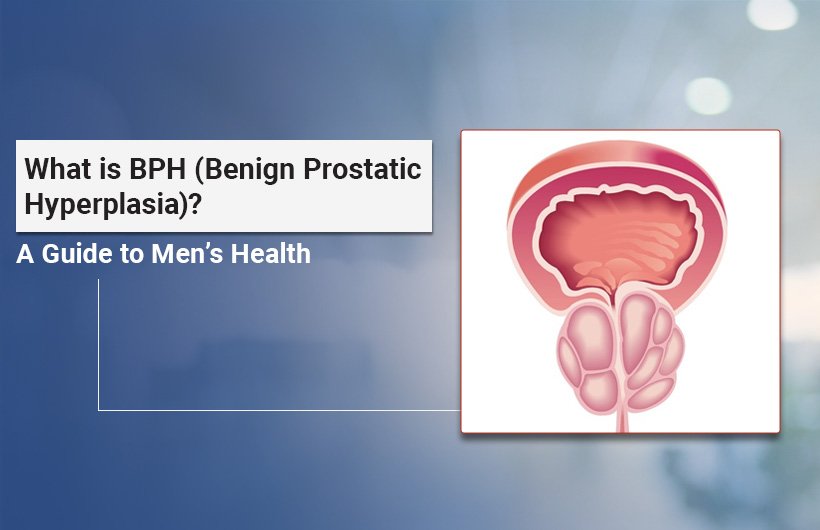 BPH and Urinary Tract Infection