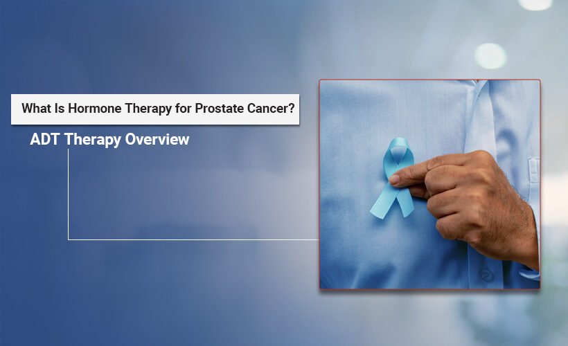 Hormone Therapy for Prostate Cancer