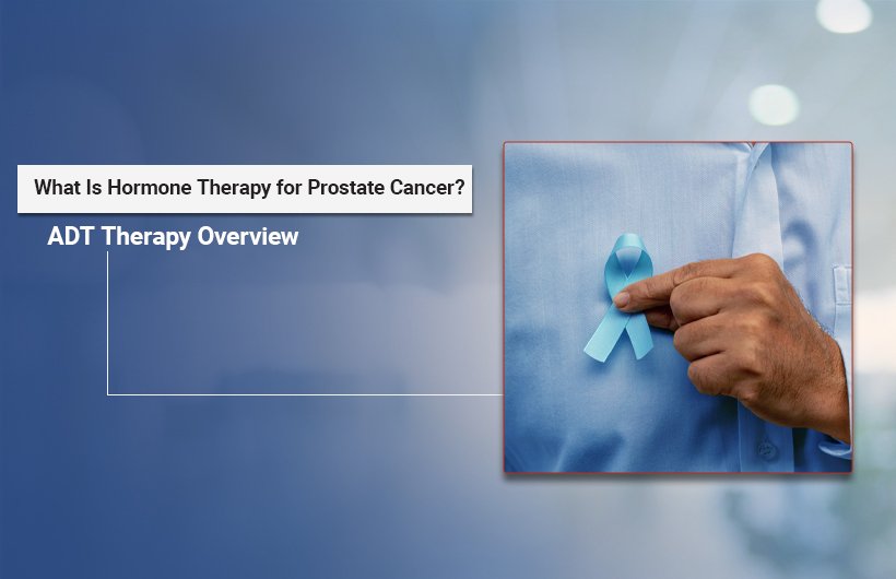 Hormone Therapy for Prostate Cancer