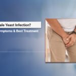 What is Male Yeast Infection Causes, Symptoms & Best Treatment Male yeast infection treatment