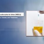 White blood cells in urine causes and treatment